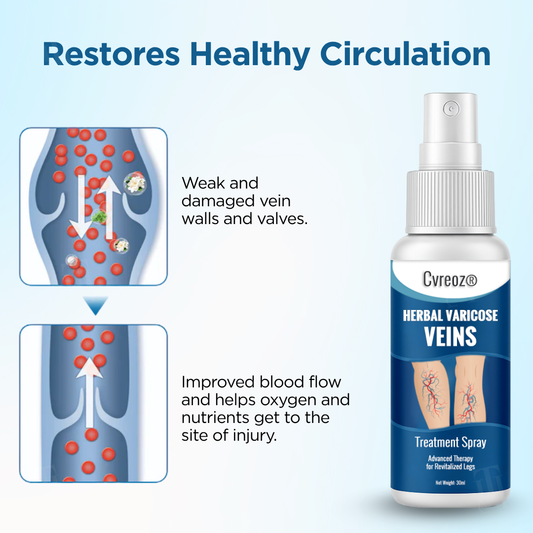 Cvreoz® Herbal Varicose Veins Treatment Spray：48-Hour Light Legs