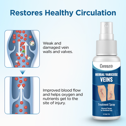 Cvreoz® Herbal Varicose Veins Treatment Spray：48-Hour Light Legs