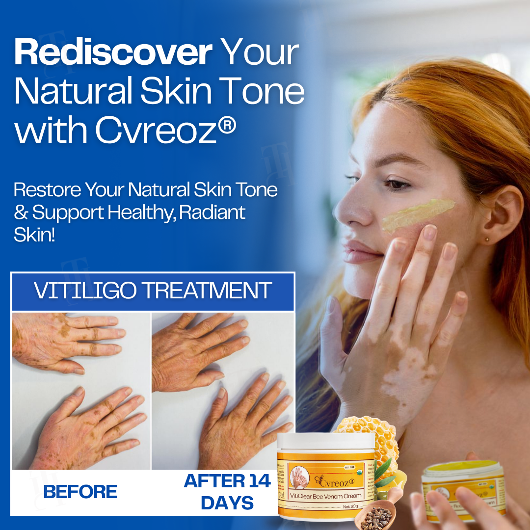 Limited Stock!! RZXEA™ VitiClear Bee Venom Cream