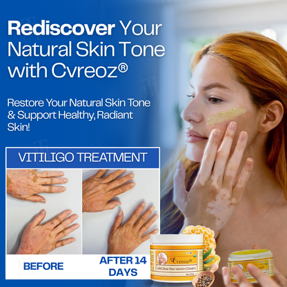 Limited Stock!! RZXEA™ VitiClear Bee Venom Cream