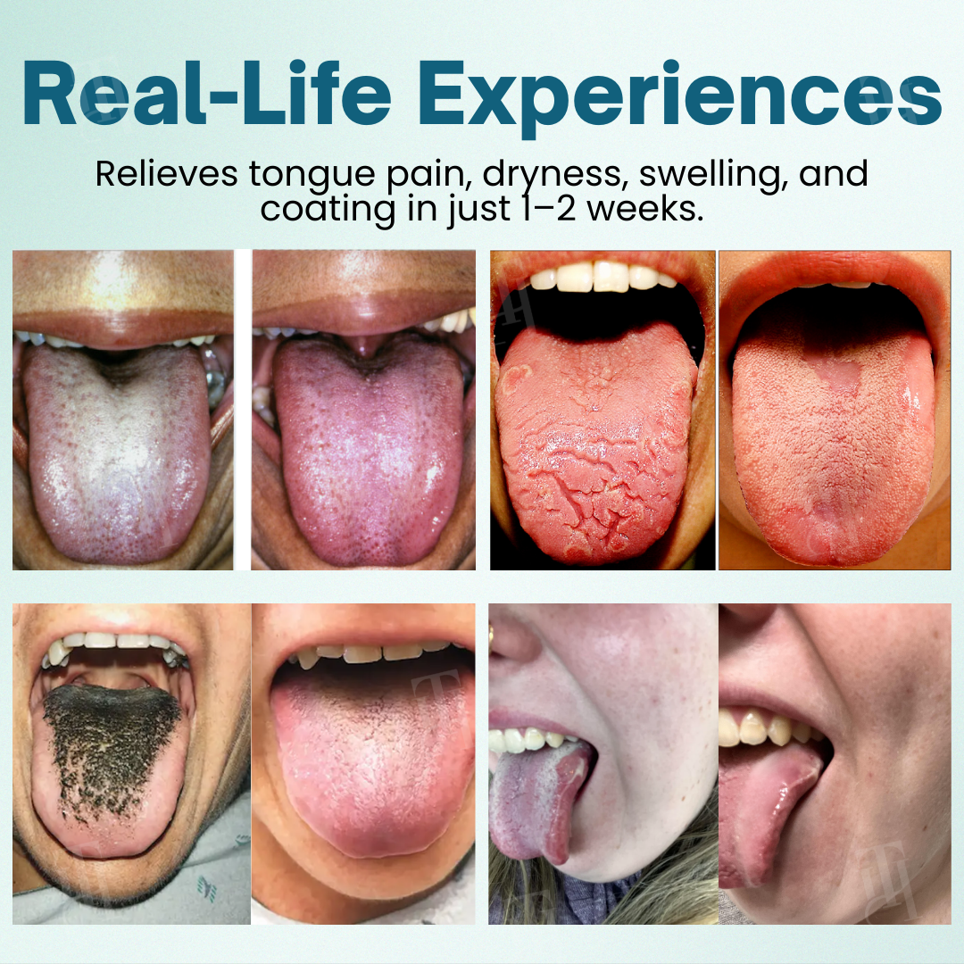 Piguiay® ProShield Tongue Restore Spray