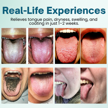 Piguiay® ProShield Tongue Restore Spray