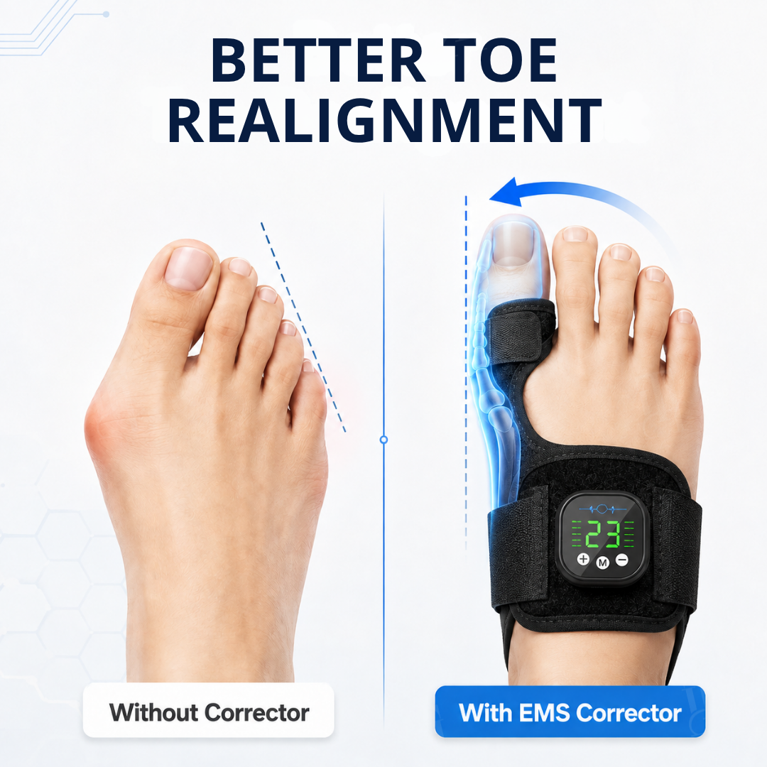 AEXZR® Nexalign Pro — EMS Bunion Corrector