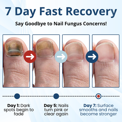 AEXZR® MycoShield Pro Fungal Nail Patches