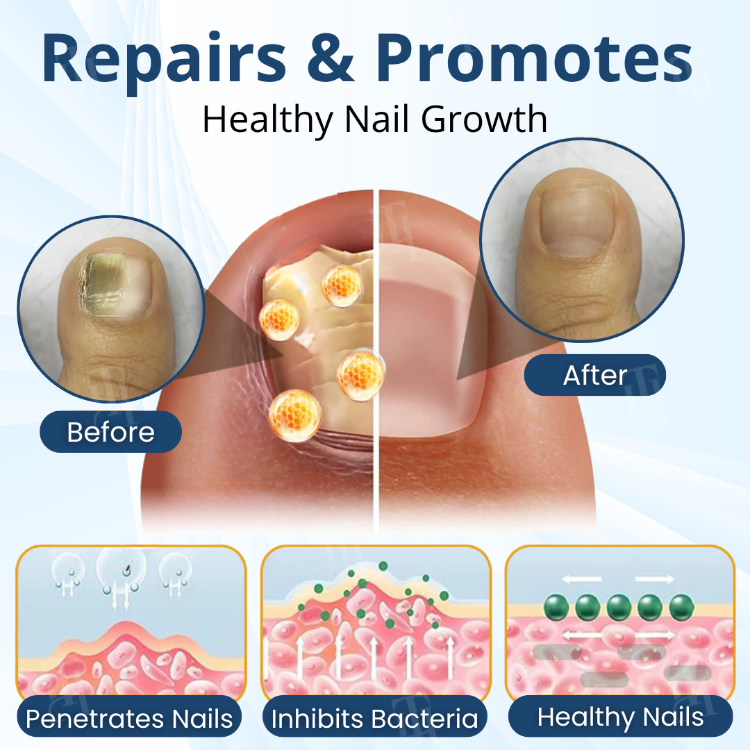 AEXZR® MycoShield Pro Fungal Nail Patches