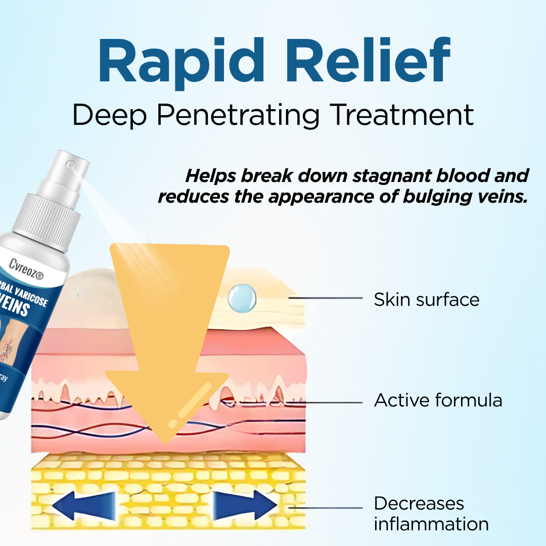 Cvreoz® Herbal Varicose Veins Treatment Spray：48-Hour Light Legs