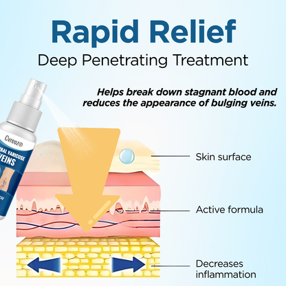 Cvreoz® Herbal Varicose Veins Treatment Spray：48-Hour Light Legs