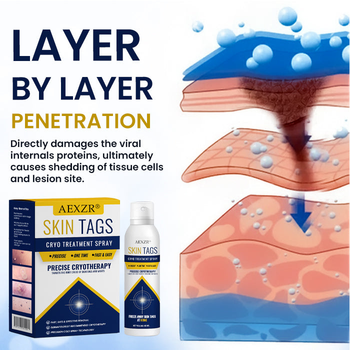 ✨ Painless At-Home Removal | AEXZR® Skin Tag Cryo Treatment Spray