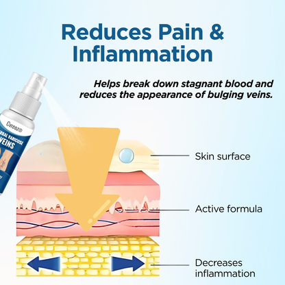 Cvreoz® Herbal Varicose Veins Treatment Spray：48-Hour Light Legs