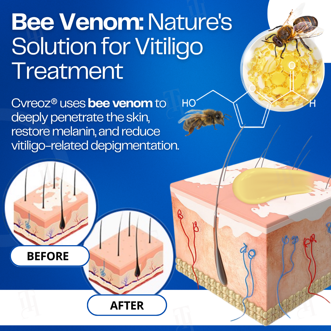 Limited Stock!! RZXEA™ VitiClear Bee Venom Cream