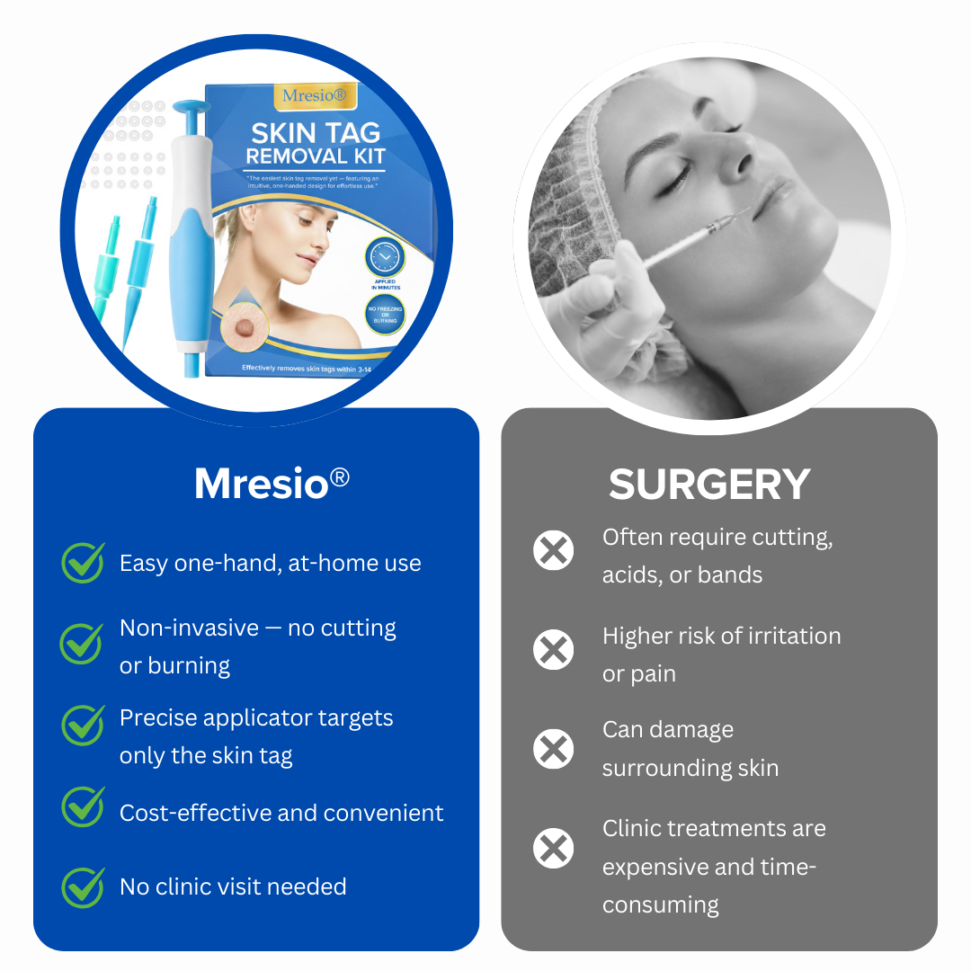 Mresio®  Skin Tag Removal Kit