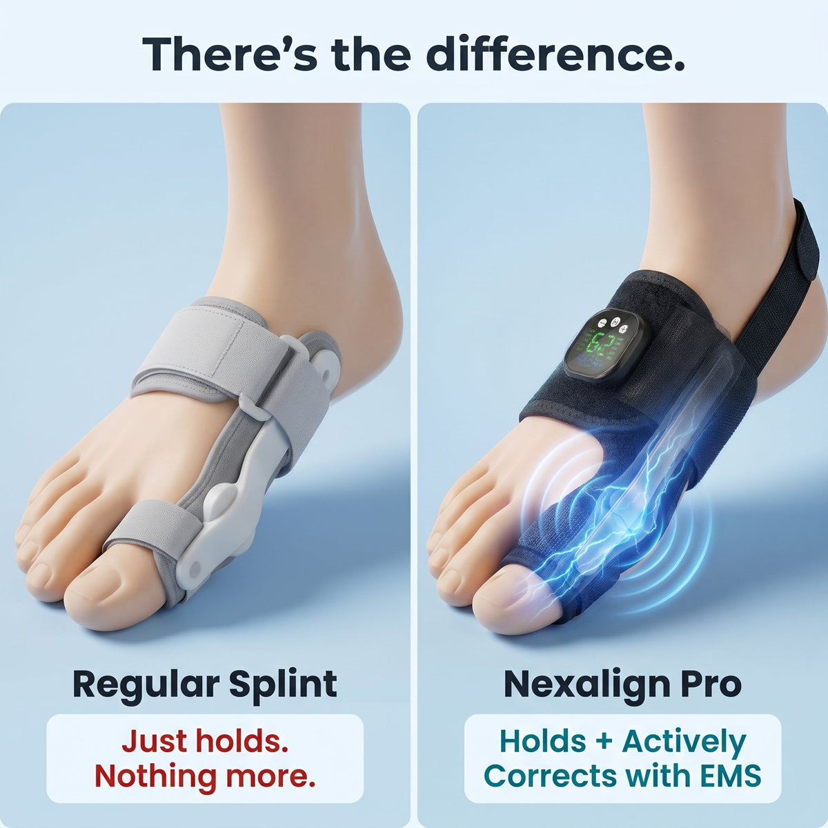 Limited Stock!!! AEXZR® Nexalign Pro — EMS Bunion Corrector